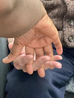 man having physio on hand with physiotherapist interlocking their hands with his